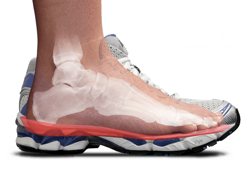 Formthotics メディカル X線画像